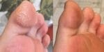 کرم ترک پا ووکالی - تصویر 3