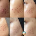 سرم ضدلک و‌ضدجوش اکسیس وای - تصویر 2
