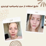 سرم نیاسینامید اوردینری  اورجینال - تصویر 2